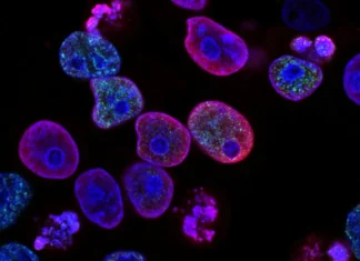 Diagnosis Kanker Langka Tak Mudah Banyak Hal Yang Dihadapi